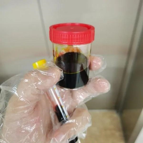 急性肝衰竭！兩兄弟誤吃這種菌 專家提醒
